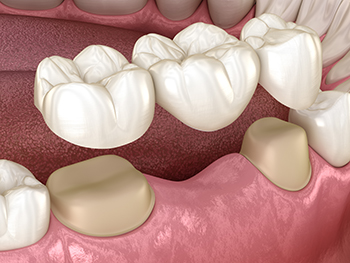 Dr Christian Vorster | Prosthodontist Strand